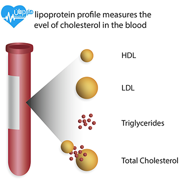 لیپد Lipid Infusion1