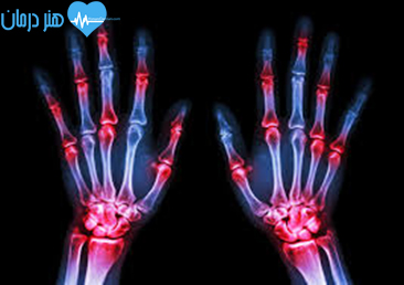 بیماری های روماتولوژی(Rheumatology)1