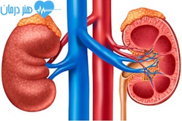 بیماری های کلیوی(Nephrology)1