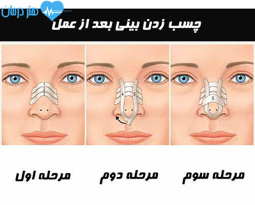 متخصص جراحی بینی1