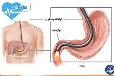 متخصص گوارش1