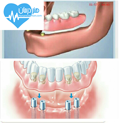 متخصص پروتزهای دندانی(پرستودنتیکس)1