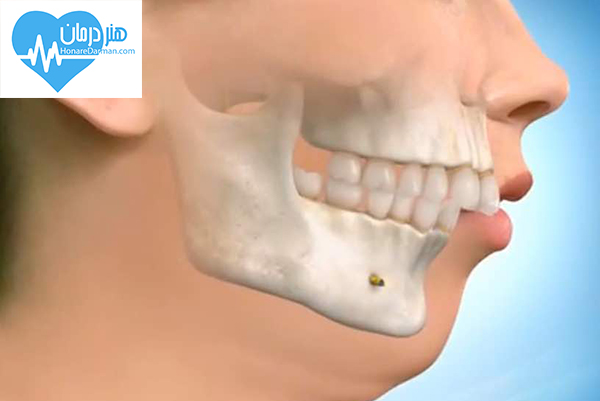 متخصص جراحی فک، دهان و صورت1