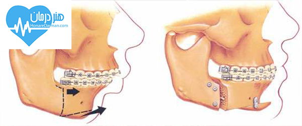 متخصص آسیب شناسی دهان، فک و صورت (پاتولوژیست دهان و دندان)1