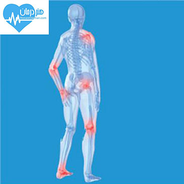 متخصص ارتوپدی - Orthopedic surgery - ارتوپد - متخصص طب فیزیکی و توانبخشی - فیزیوتراپیست - کاردرمانگر - متخصص درد