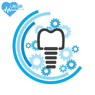 متخصص ایمپلنت - پروتز دندان - پروتزهای ثابت - پروتزهای متحرک - کاشت دندان متخصص ایمپلنت - پروتز دندان - پروتزهای ثابت - پروتزهای متحرک - کاشت دندان