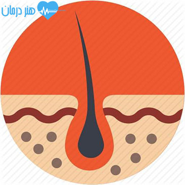 متخصص پوست و مو - اختلالات زیبایی - cosmetic disorders - انجمن متخصصین پوست - زیبایی پوست و لیزر - درماتوپاتولوژی - جراح زیبایی پوست متخصص پوست و مو - اختلالات زیبایی - cosmetic disorders - انجمن متخصصین پوست - زیبایی پوست و لیزر - درماتوپاتولوژی - جراح زیبایی پوست