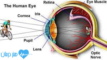 متخصص چشم - بیماری‌هاي چشم - اختلالات چشم - عفونت میکروبی چشم - متخصص چشم در تهران - پزشک چشم - متخصص چشم کودکان