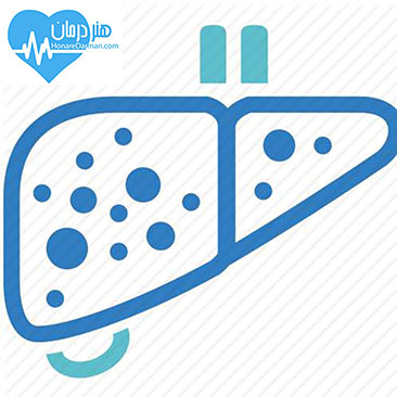 درمان کبد چرب - کبد چرب - کبد چرب گرید 1 - کبد چرب گرید 2 - کبد چرب گرید 3 - خارمریم - پیشگیری از کبد چرب