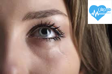 عوامل آبریزش چشم , درمان آبریزش چشم , مجاری اشک , ضربه به چشم , اشک مصنوعی , پزشک متخصص , دکتر خوب