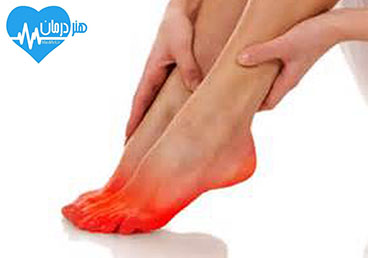 سوختن پا- داغی پا- سوزن سوزن شدن پا- کرختی پا- مورمور شدن پا- پزشک خوب- دکتر خوب عوامل سوختن پا , داغی پا , سوزن سوزن شدن پا , کرختی پا , مورمور شدن پا , پزشک خوب , دکتر خوب