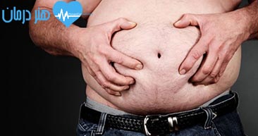 برجستگی غیر عادی شکم - استعداد چاق شدن - اضافه وزن - بیماری کبدی