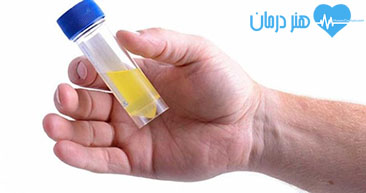 نمونه ادرار - کشت ادرار - عفونت ادراری نمونه ادرار - کشت ادرار - عفونت ادراری